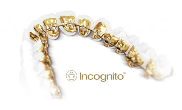 Incognito™ Appliance System logo